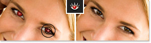 Red Eye Removal
